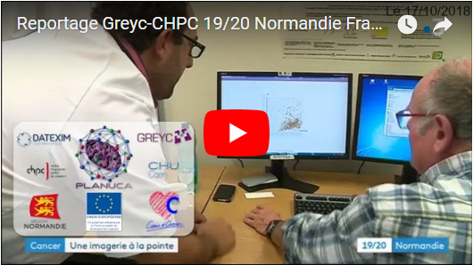 miniature youtube du reportage France 3 Normandie sur l'analyse d'image GREYC-CHPC